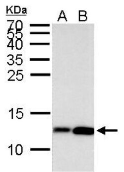 Histone H4, ac Lys8 Antibody, Novus Biologicals 0.1mL:Antibodies, Polyclonal